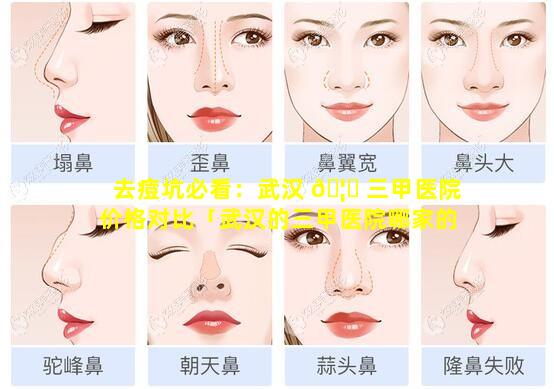 去痘坑必看：武汉 🦆 三甲医院价格对比「武汉的三甲医院哪家的皮肤科好一些 🪴 」